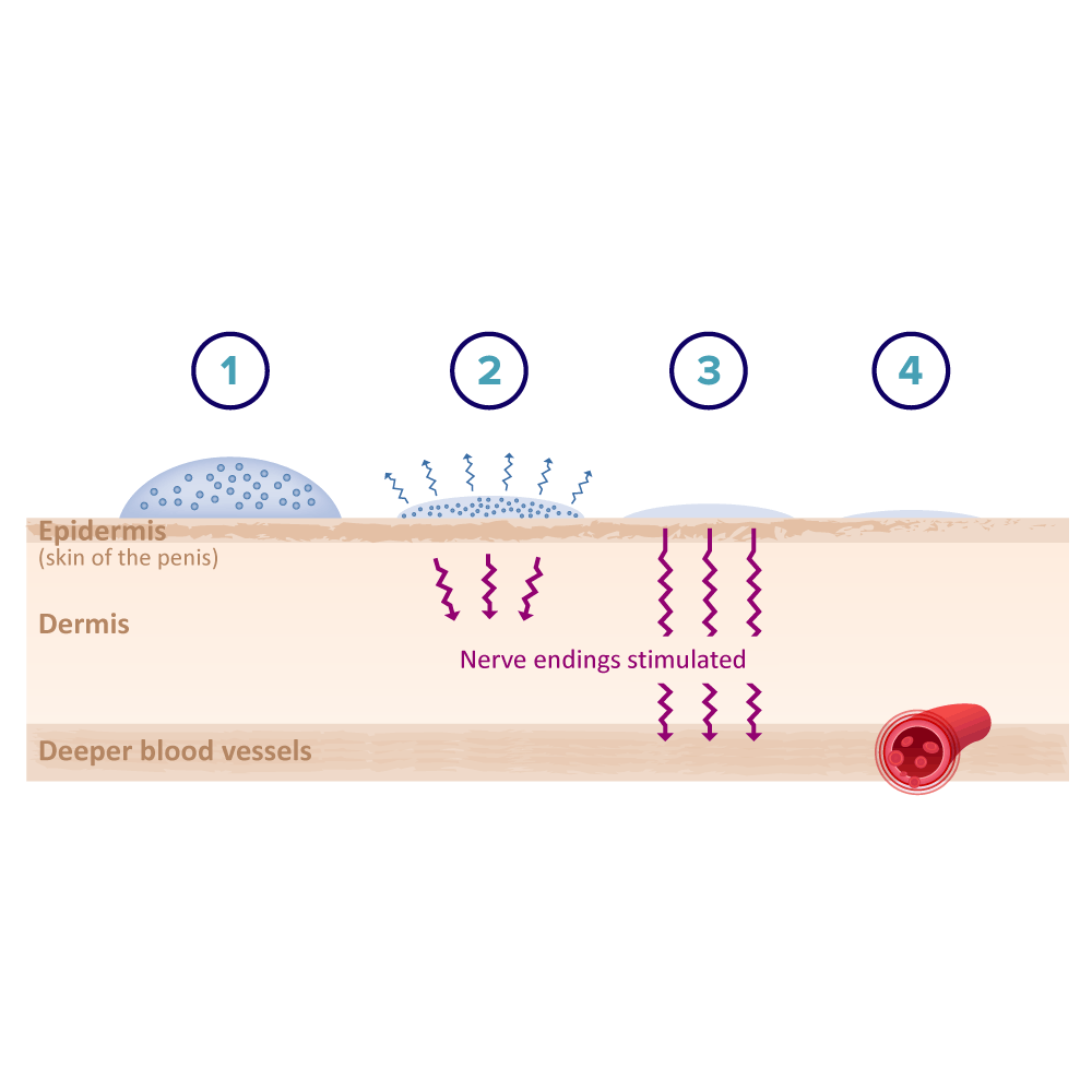 An infographic demonstrating how Eroxon gel works in 4 steps, with arrows depicting how the gel works through the epidermis, dermis and corporal tissues.